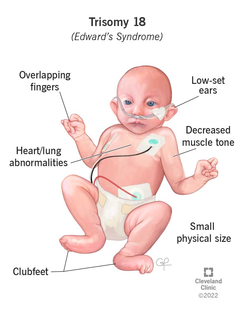 my.clevelandclinic.org