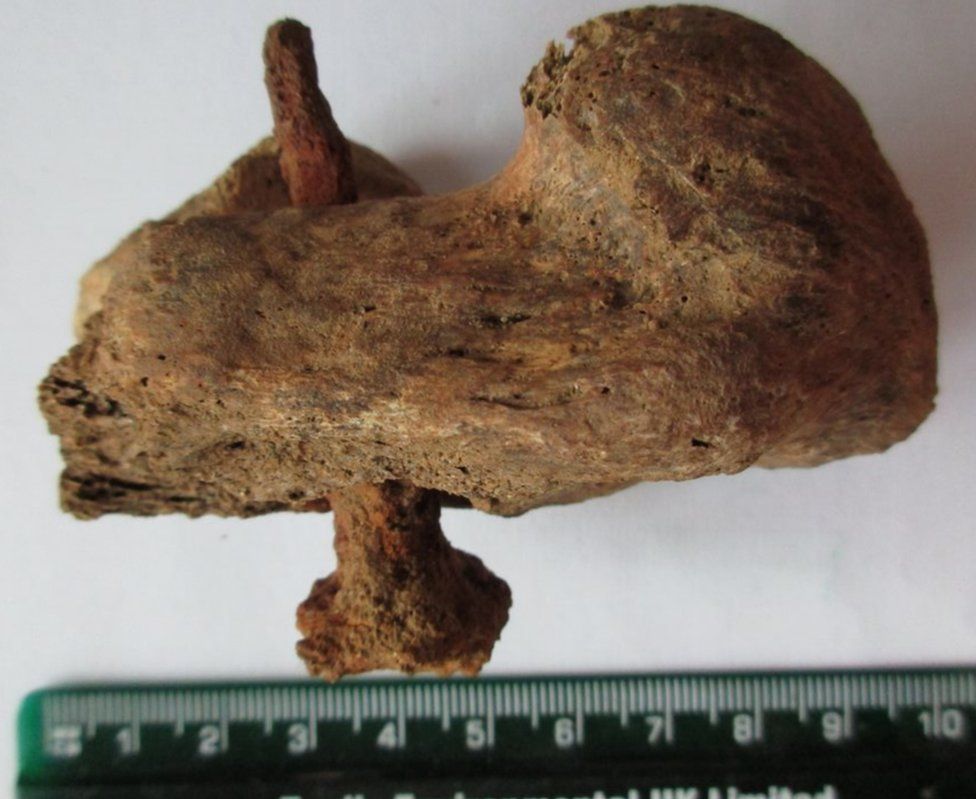 Nail in heel bone Nail in heel bone
